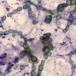 Brewers Yeast cells seen through a microscope: Photo 156143200 © Chirawan Somsanuk | Dreamstime.com