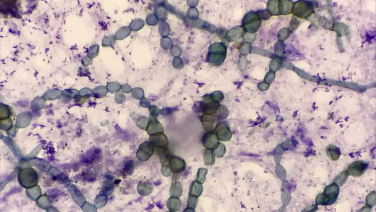 Brewers Yeast cells seen through a microscope: Photo 156143200 © Chirawan Somsanuk | Dreamstime.com