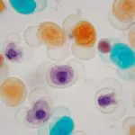 Differently colored pollen grains under a microscope: Photo 138199652 © Christian Weiß | Dreamstime.com