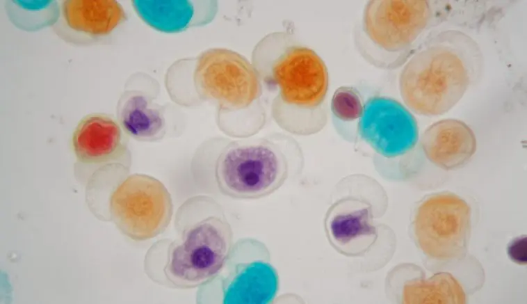 Differently colored pollen grains under a microscope: Photo 138199652 © Christian Weiß | Dreamstime.com