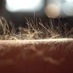 Closeup of goosebumps on a human arm: Photo 190232978 © Domenico Fornas | Dreamstime.com