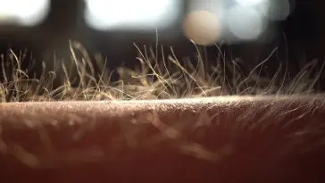 Closeup of goosebumps on a human arm: Photo 190232978 © Domenico Fornas | Dreamstime.com