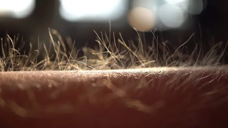 Closeup of goosebumps on a human arm: Photo 190232978 © Domenico Fornas | Dreamstime.com