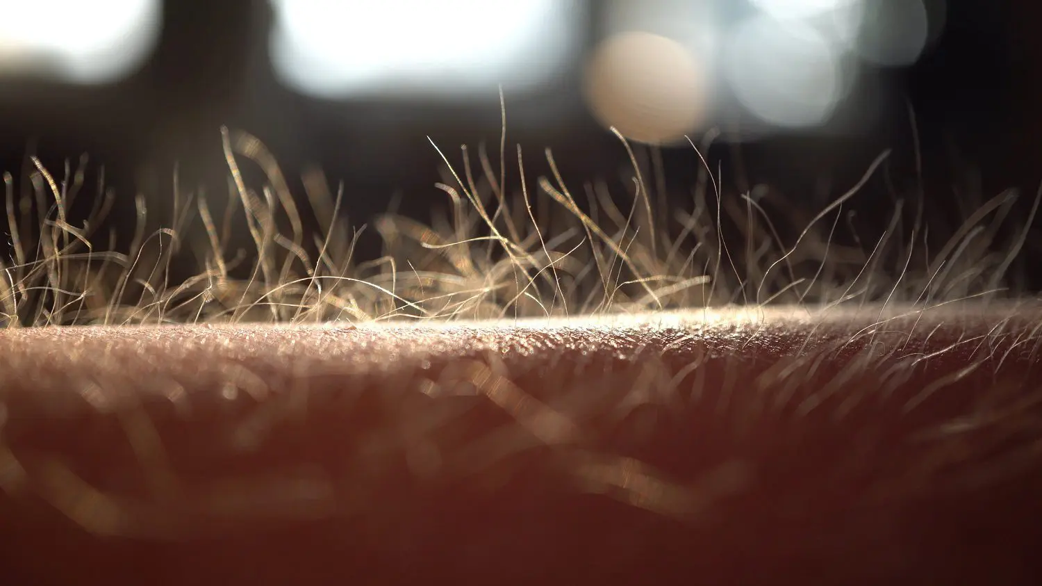 Closeup of goosebumps on a human arm: Photo 190232978 © Domenico Fornas | Dreamstime.com