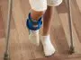 Child with broken ankle: ID 338711557 © Famveldman | Dreamstime.com