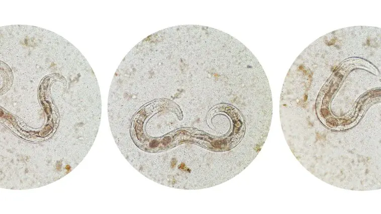 Strongyloides stercoralis a human pathogenic parasitic roundworm causing the disease strongyloidiasis: ID 81603414 © Chansom Pantip | Dreamstime.com