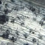 Arbuscular mycorrhiza seen under microscope. Flax root cortical cells containing paired arbuscules. Photo credit: MS Turmel, University of Manitoba, Plant Science Department