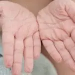Wet, wrinkled palms and fingers: ID 194128816 © Anna Pecherskaia | Dreamstime.com