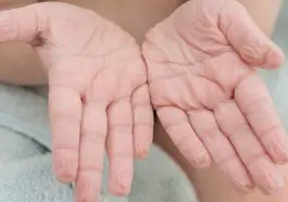 Wet, wrinkled palms and fingers: ID 194128816 © Anna Pecherskaia | Dreamstime.com