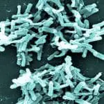 Clostridium difficile under an electron microscope, photo credit: CDC