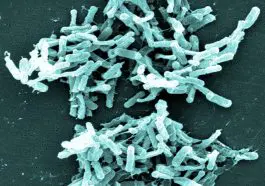 Clostridium difficile under an electron microscope, photo credit: CDC