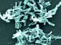 Clostridium difficile under an electron microscope, photo credit: CDC