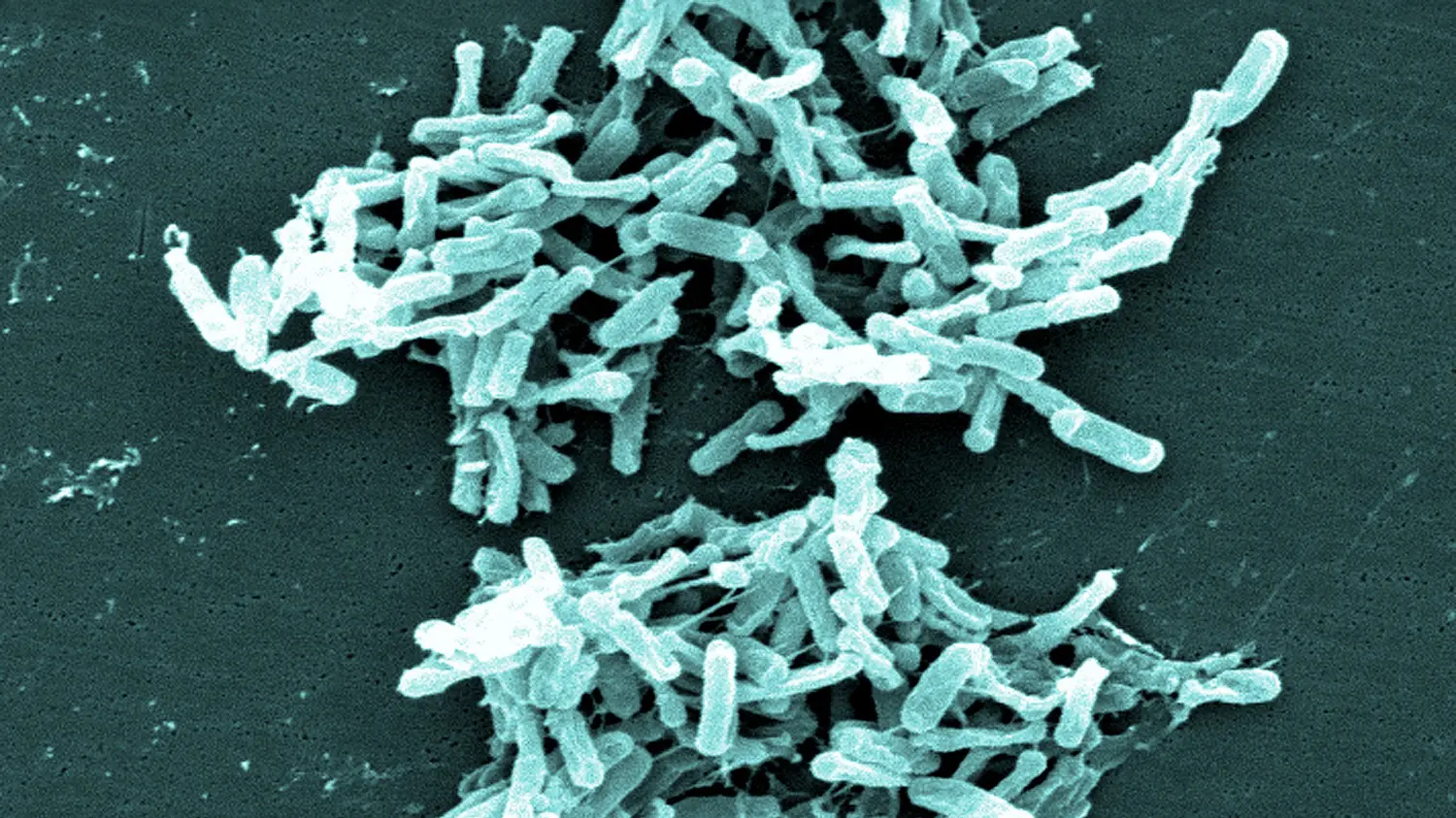 Clostridium difficile under an electron microscope, photo credit: CDC