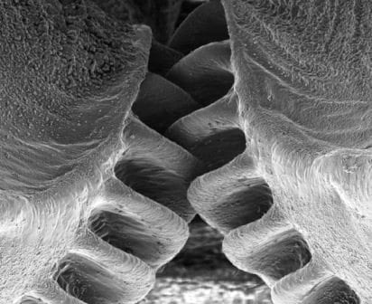 electron microscope image of the leg gears of the nymph planthopper