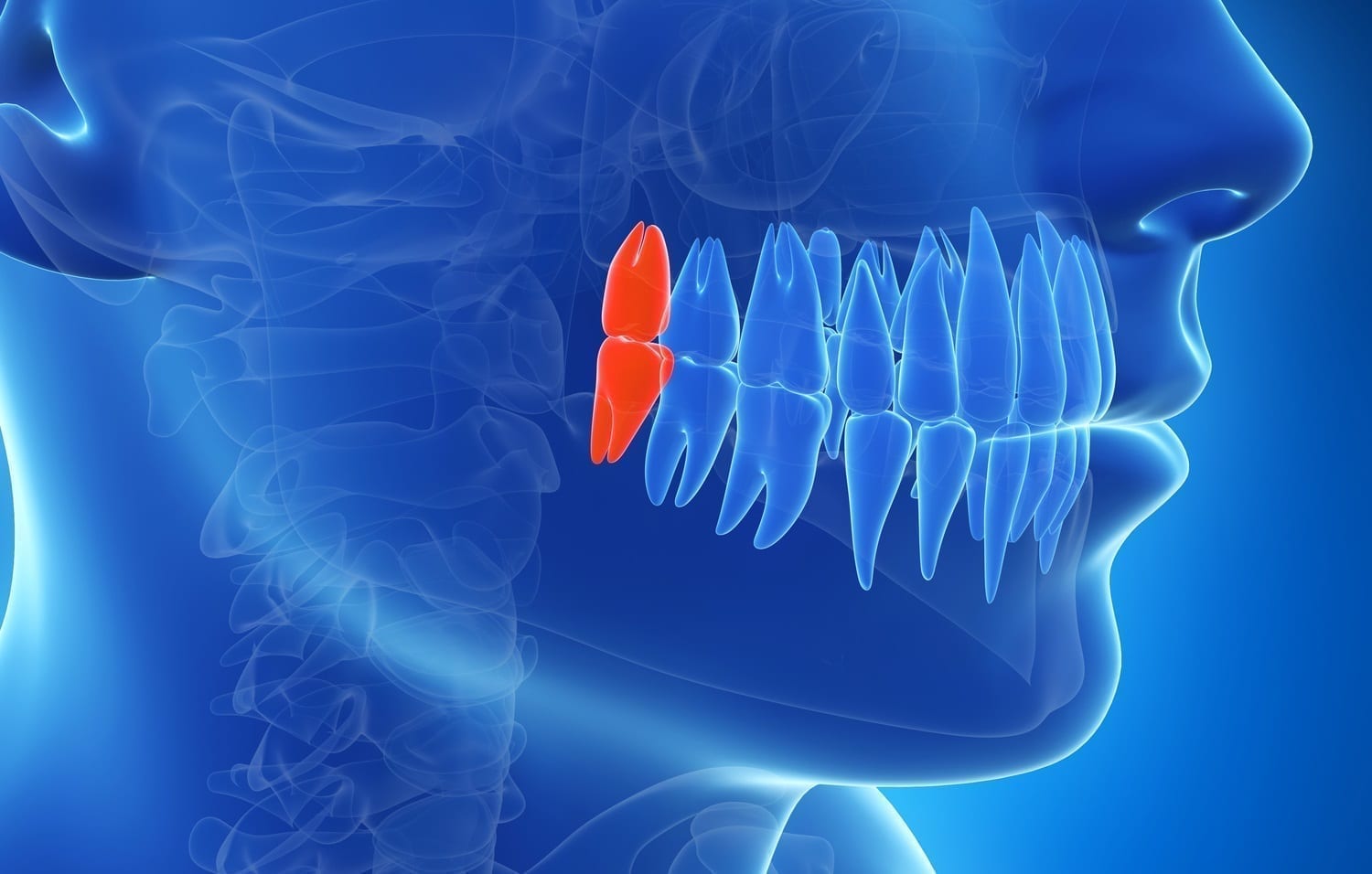 3D illustration of wisdom teeth: ID 30725958 © Sebastian Kaulitzki | Dreamstime.com