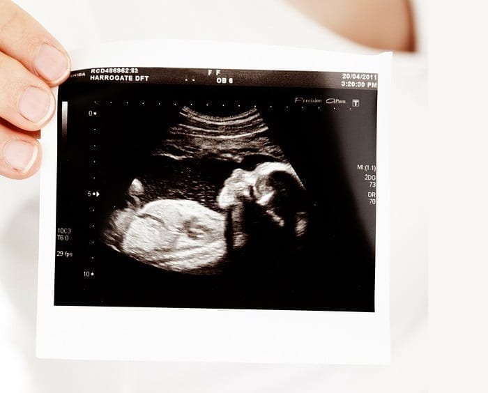 Ultrasound being held up for view, photo credit PIxabay