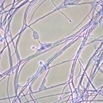 Photomicrograph of mycelia, conidiophores and conidia of the fungus Acremonium recifei. Photo credit: USA Public Health Images