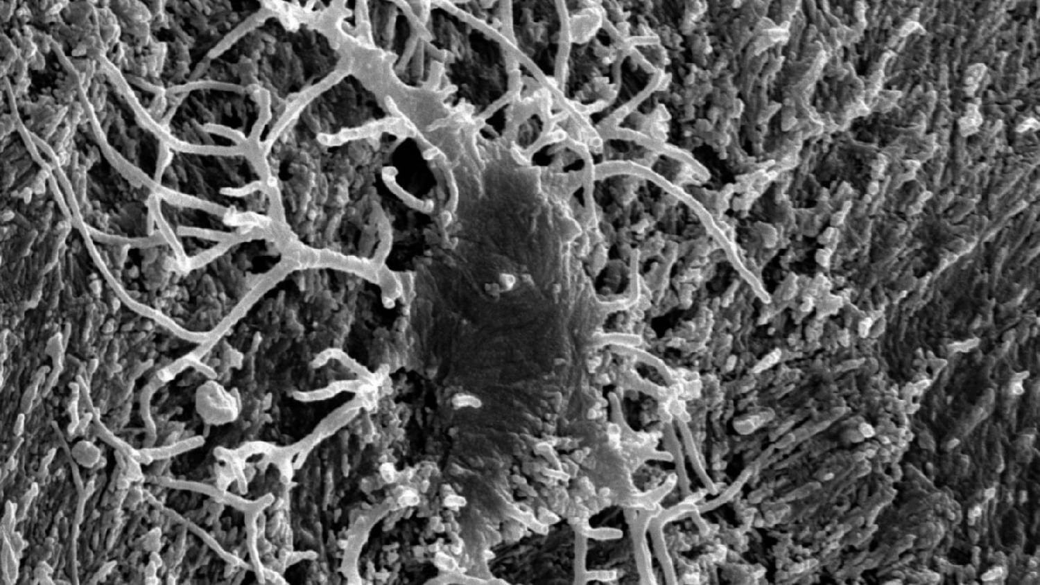 Dinosaur bone tissue electron microscope image feature size, photo credit: Mark Armitage